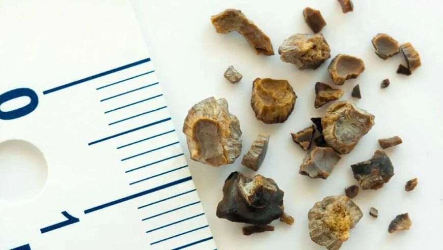 谁给姜妍涂的粉底,2025王中王免费资料大全料大全一一,经济性执行方案剖析_手游版V6.58